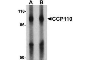 Western blot analysis of CCP110 in human colon tissue lysate with CCP110 Antibody  at (A) 1 and (B) 2 ug/mL. (Centriolin Antikörper  (C-Term))