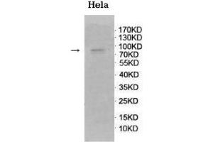 Western blot analysis of fetal brain lysate using GnT-V Antibody at a dilution of 1/500. (MGAT5 Antikörper  (C-Term))