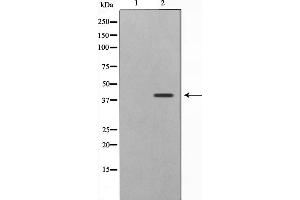 Western blot analysis on 293 cell lysate using CBX6 Antibody,The lane on the left is treated with the antigen-specific peptide. (CBX6 Antikörper  (N-Term))