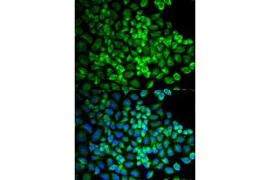 Immunofluorescence analysis of U2OS cells using GRIA3 antibody.