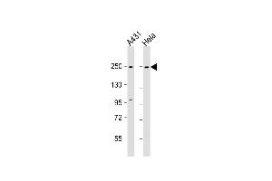 All lanes : Anti-MYH9 Antibody (N-term ) at 1:1000 dilution Lane 1: A431 whole cell lysate Lane 2: Hela whole cell lysate Lysates/proteins at 20 μg per lane. (Myosin 9 Antikörper  (N-Term))