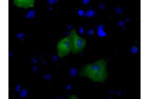 Anti-BTK mouse monoclonal antibody (ABIN2452830) immunofluorescent staining of COS7 cells transiently transfected by pCMV6-ENTRY BTK (RC211582). (BTK Antikörper)