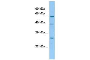 WB Suggested Anti-2700060E02Rik Antibody   Titration: 1.