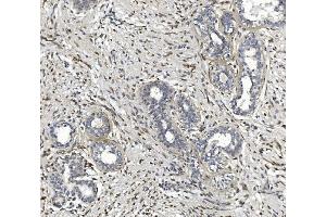 IHC analysis of CTHRC1 using anti-CTHRC1 antibody (ABIN7601256). (CTHRC1 Antikörper  (AA 31-243))