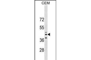 QPCT Antibody (C-term) (ABIN1537117 and ABIN2849049) western blot analysis in CEM cell line lysates (35 μg/lane).