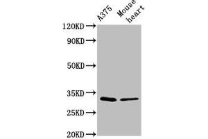 Western Blot Positive WB detected in: A375 whole cell lysate, Mouse heart tissue All lanes: TIMMDC1 antibody at 2. (TIMMDC1 Antikörper  (AA 444-585))