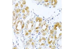 Immunohistochemistry of paraffin-embedded human stomach using TDGF1 antibody (ABIN3021341, ABIN3021342, ABIN3021343 and ABIN6214922) at dilution of 1:100 (40x lens). (TDGF1 Antikörper  (AA 1-188))