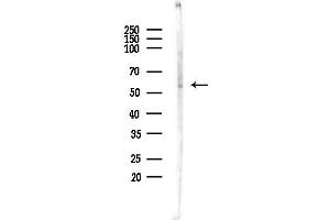 Western blot analysis of lysates from Rat brain, using SN Antibody at 1/1000 dilution.