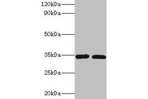 Western blot All lanes: CASP7 antibody at 2 μg/mL Lane 1: A549 whole cell lysate Lane 2: HGC-27 whole cell lysate Secondary Goat polyclonal to rabbit IgG at 1/10000 dilution Predicted band size: 35, 29, 38, 32 kDa Observed band size: 35 kDa
