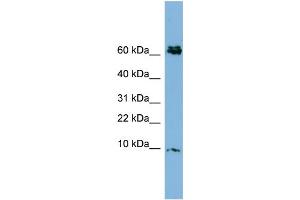 WB Suggested Anti-CRIP1  Antibody Titration: 0.