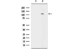 anti-Discoidin Domain Receptor tyrosine Kinase 1 (DDR1) (Internal Region) antibody