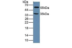 Figure. (LOXL1 Antikörper  (AA 392-598))