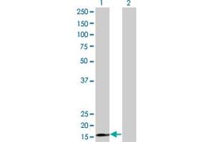 Western Blot analysis of RPS15 expression in transfected 293T cell line by RPS15 monoclonal antibody (M01), clone 4H8. (RPS15 Antikörper  (AA 77-145))