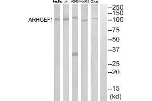 Western blot analysis of extracts from COLO205, HepG2, HuvEc and Jurkat cells, using ARHGEF1 antibody. (ARHGEF1 Antikörper  (Internal Region))