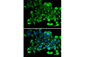 Immunofluorescence analysis of A-549 cells using CLIC4 antibody (ABIN6127638, ABIN6138723, ABIN6138724 and ABIN6222890). (CLIC4 Antikörper  (AA 1-253))