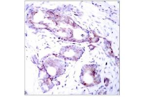Image no. 1 for anti-Myc Proto-Oncogene protein (MYC) (pSer373) antibody (ABIN196677) (c-MYC Antikörper  (pSer373))