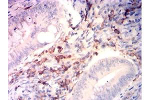 Immunohistochemical analysis of paraffin-embedded rectum cancer tissues using CD14 mouse mAb with DAB staining. (CD14 Antikörper  (AA 230-345))