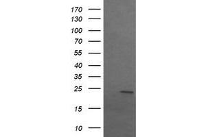Image no. 2 for anti-Sex Determining Region Y (SRY) antibody (ABIN1501139) (SRY Antikörper)