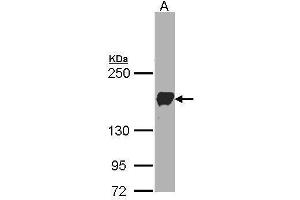 WB Image Sample(30 ug whole cell lysate) A:A431, 5% SDS PAGE antibody diluted at 1:1000