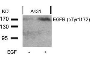 Image no. 2 for anti-Epidermal Growth Factor Receptor (EGFR) (pTyr1172) antibody (ABIN196960) (EGFR Antikörper  (pTyr1172))