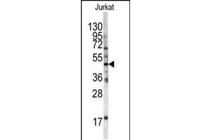 Western blot analysis of HFE antibody in Jurkat cell line lysates (35ug/lane) (HFE Antikörper  (AA 122-148))
