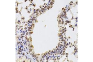 Immunohistochemistry of paraffin-embedded mouse lung using AAAS Antibody. (Adracalin Antikörper  (AA 287-546))