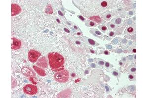 Anti-SERPINB2 / PAI-2 antibody IHC staining of human placenta. (SERPINB2 Antikörper)