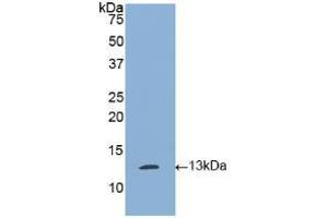 Western blot analysis of recombinant Human tPA. (PLAT Antikörper  (AA 36-126))