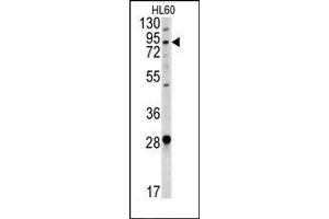 Image no. 1 for anti-Angiotensin I Converting Enzyme 2 (ACE2) (Center) antibody (ABIN358576) (ACE2 Antikörper  (Center))