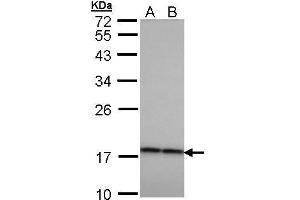 WB Image Sample (30 ug of whole cell lysate) A: H1299 B: HeLa 12% SDS PAGE antibody diluted at 1:1000 (CRYbA4 Antikörper)