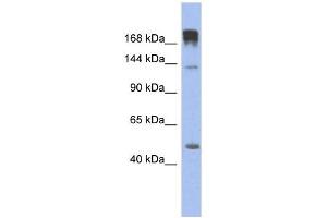 SLIT3 antibody used at 1 ug/ml to detect target protein. (SLIT3 Antikörper)