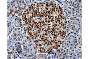 Immunohistochemical staining of paraffin-embedded liver tissue using anti-RALBP1 mouse monoclonal antibody. (RALBP1 Antikörper)