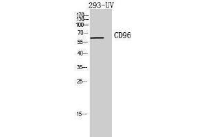 Western Blotting (WB) image for anti-CD96 (CD96) (Internal Region) antibody (ABIN3181440)