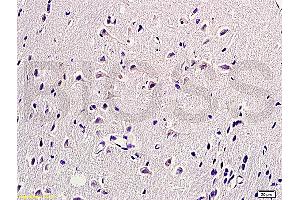 Formalin-fixed and paraffin embedded rat brain labeled with  (ABIN672441)  Rabbit Anti-HSP27 HspB1 HSP25 Polyclonal Antibody, unconjugated 1: 200 followed by incubation with conjugated secondary antibody and DAB staining.