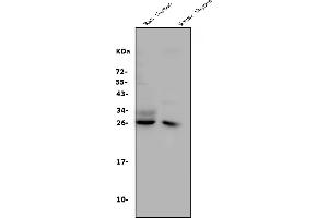 Western blot analysis of CD8 alpha/Cd8a using anti-CD8 alpha/Cd8a antibody (ABIN7601570). (CD8 alpha Antikörper  (AA 39-245))
