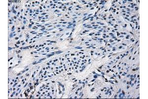 Immunohistochemical staining of paraffin-embedded Ovary tissue using anti-CYP2E1 mouse monoclonal antibody. (CYP2E1 Antikörper)