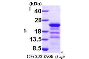 SDS-PAGE (SDS) image for Human Immunodeficiency Virus 1 Capsid (HIV-1 p24) (AA 155-321) protein (His tag) (ABIN667810) (HIV-1 p24 Protein (AA 155-321) (His tag))