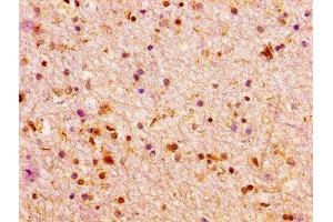 IHC image of ABIN7155649 diluted at 1:100 and staining in paraffin-embedded human brain tissue performed on a Leica BondTM system. (Arx Antikörper  (AA 381-460))