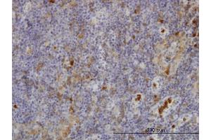 Immunoperoxidase of monoclonal antibody to FGR on formalin-fixed paraffin-embedded human lymph node. (Fgr Antikörper  (AA 1-90))