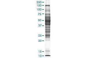 Image no. 1 for Rat liver tissue lysate (non-denatured) (ABIN1339615) (Rattete liver tissue lysate (non-denatured))