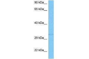 Host:  Mouse  Target Name:  SMN1  Sample Tissue:  Mouse Kidney  Antibody Dilution:  1ug/ml (SMN1 Antikörper  (N-Term))