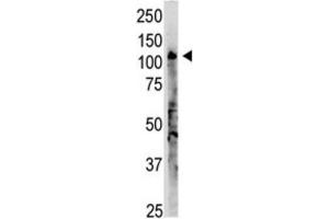 Western Blotting (WB) image for anti-2'-5' Oligoadenylate Synthetase 3 (OAS3) antibody (ABIN3002560) (OAS3 Antikörper)