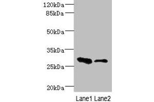 Western blot All lanes: EAF2 antibody at 3. (EAF2 Antikörper  (AA 1-170))