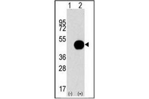 Western blot analysis of APG4B (arrow) using APG4B / ATG4B Antibody . (ATG4B Antikörper  (AA 264-293))