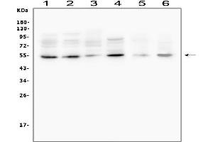 anti-Matrix Metallopeptidase 13 (Collagenase 3) (MMP13) (AA 99-335) antibody