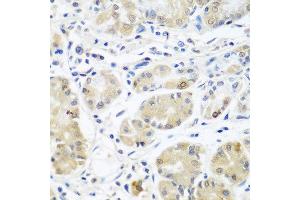 Immunohistochemistry of paraffin-embedded human stomach using EIF3A antibody at dilution of 1:100 (40x lens). (EIF3A Antikörper)