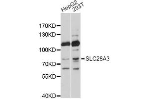 Western blot analysis of extracts of various cell lines, using SLC28A3 antibody. (SLC28A3 Antikörper)