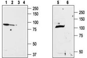 Western blot analysis of ND7/23 cell line membrane (lanes 1 and 3), RBL lysates (lanes 2 and 4) and rat brain membrane (lanes 5and 6): - 1,2,5.