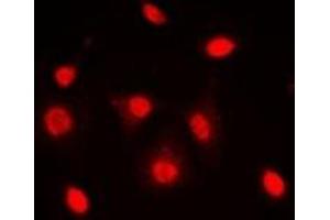 Immunofluorescent analysis of Dyskerin staining in MCF7 cells.