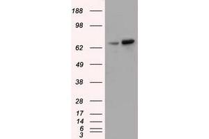 Western Blotting (WB) image for anti-Sorting Nexin 9 (SNX9) antibody (ABIN1501046) (SNX9 Antikörper)